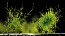 EIN PILZ ALS LEBENDE FABRIK
Die Schimmelpilzart Aspergillus niger ist von Natur aus in der Lage, verschiedene technisch nutzbare Enzyme wie Phytase, Glucanase und Xylanase zu bilden. Allerdings produziert der Pilz auf natürlichem Wege nur geringe Mengen dieser Biokatalysatoren. Mit Hilfe gentechnischer Methoden wurde dieser Mikroorganismus so optimiert, dass er  sozusagen wie eine lebende Fabrik  große Mengen an Phytase und anderen Enzymen herstellt.
Vergrößerung  180 : 1 (bei 12cm Bildbreite)
Abdruck honorarfrei. Copyright by BASF.
A FUNGUS AS A LIVING FACTORY
The filamentous fungus Aspergillus niger has the natural capacity to produce various technically useful enzymes such as phytase, glucanase and xylanase. However it is only able to produce these biocatalysts in small quantities. The microorganism was genetically modified to enable it to manufacture large quantities of phytase and other enzymes  as a kind of living factory.
Magnification  180 :1 (12cm in width)
Print free of charge. Copyright by BASF.,EIN PILZ ALS LEBENDE FABRIK
Die Schimmelpilzart Aspergillus niger ist von Natur aus in der Lage, verschiedene technisch nutzbare Enzyme wie Phytase, Glucanase und Xylanase zu bilden. Allerdings produziert der Pilz auf natürlichem Wege nur geringe Mengen dieser Biokatalysatoren. Mit Hilfe gentechnischer Methoden wurde dieser Mikroorganismus so optimiert, dass er – sozusagen wie eine lebende Fabrik – große Mengen an Phytase und anderen Enzymen herstellt.
Vergrößerung  180 : 1 (bei 12cm Bildbreite)
Abdruck honorarfrei. Copyright by BASF.
A FUNGUS AS A LIVING FACTORY
The filamentous fungus Aspergillus niger has the natural capacity to produce various technically useful enzymes such as phytase, glucanase and xylanase. However it is only able to produce these biocatalysts in small quantities. The microorganism was genetically modified to enable it to manufacture large quantities of phytase and other enzymes – as a kind of living factory.
Magnification  180 :1 (12cm in width)
Print free of charge. Copyright by BASF. EIN PILZ ALS LEBENDE FABRIK
Die Schimmelpilzart Aspergillus niger ist von Natur aus in der Lage, verschiedene technisch nutzbare Enzyme wie Phytase, Glucanase und Xylanase zu bilden. Allerdings produziert der Pilz auf natürlichem Wege nur geringe Mengen dieser Biokatalysatoren. Mit Hilfe gentechnischer Methoden wurde dieser Mikroorganismus so optimiert, dass er  sozusagen wie eine lebende Fabrik  große Mengen an Phytase und anderen Enzymen herstellt.
Vergrößerung  180 : 1 (bei 12cm Bildbreite)
Abdruck honorarfrei. Copyright by BASF.
A FUNGUS AS A LIVING FACTORY
The filamentous fungus Aspergillus niger has the natural capacity to produce various technically useful enzymes such as phytase, glucanase and xylanase. However it is only able to produce these biocatalysts in small quantities. The microorganism was genetically modified to enable it to manufacture large quantities of phytase and other enzymes  as a kind of living factory.
Magnification  180 :1 (12cm in width)
Print free of charge. Copyright by BASF.,EIN PILZ ALS LEBENDE FABRIK
Die Schimmelpilzart Aspergillus niger ist von Natur aus in der Lage, verschiedene technisch nutzbare Enzyme wie Phytase, Glucanase und Xylanase zu bilden. Allerdings produziert der Pilz auf natürlichem Wege nur geringe Mengen dieser Biokatalysatoren. Mit Hilfe gentechnischer Methoden wurde dieser Mikroorganismus so optimiert, dass er – sozusagen wie eine lebende Fabrik – große Mengen an Phytase und anderen Enzymen herstellt.
Vergrößerung  180 : 1 (bei 12cm Bildbreite)
Abdruck honorarfrei. Copyright by BASF.
A FUNGUS AS A LIVING FACTORY
The filamentous fungus Aspergillus niger has the natural capacity to produce various technically useful enzymes such as phytase, glucanase and xylanase. However it is only able to produce these biocatalysts in small quantities. The microorganism was genetically modified to enable it to manufacture large quantities of phytase and other enzymes – as a kind of living factory.
Magnification  180 :1 (12cm in width)
Print free of charge. Copyright by BASF.