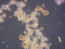 The microorganisms used in the new plant include the fungus Penicillium coprobium, which is fermented to produce the direct precursor of the insecticide Inscalis®. The picture shows the fungal cells in its fermentation broth. Photo: BASF SE The microorganisms used in the new plant include the fungus Penicillium coprobium, which is fermented to produce the direct precursor of the insecticide Inscalis®. The picture shows the fungal cells in its fermentation broth. Photo: BASF SE