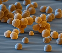 BASF is conducting global research into innovative cathode active materials that, depending on their composition, can be used in batteries for small to luxury cars. That’s how innovations from BASF are helping to further advance electromobility. Cathode active materials whose particles are as uniform as possible and have a regular surface area can be packed more homogeneously and densely in the electrode. This results in a longer driving range for the electric car. Magnification 1400:1 BASF is conducting global research into innovative cathode active materials that, depending on their composition, can be used in batteries for small to luxury cars. That’s how innovations from BASF are helping to further advance electromobility. Cathode active materials whose particles are as uniform as possible and have a regular surface area can be packed more homogeneously and densely in the electrode. This results in a longer driving range for the electric car. Magnification 1400:1